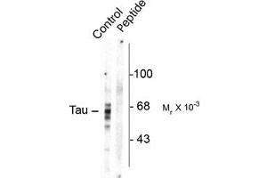 Image no. 1 for anti-Microtubule-Associated Protein tau (MAPT) (pSer416) antibody (ABIN303964) (MAPT Antikörper  (pSer416))