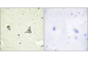 Immunohistochemistry (IHC) image for anti-Colony Stimulating Factor 1 Receptor (CSF1R) (AA 691-740) antibody (ABIN2888738) (CSF1R Antikörper  (AA 691-740))
