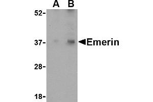 Western blot analysis of Emerin in human skeletal muscle tissue lysate with Emerin antibody at (A) 0. (Emerin Antikörper  (N-Term))