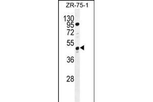 tcag7. (Tcag7.1071 (AA 410-438), (C-Term) Antikörper)