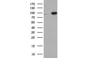 Western Blotting (WB) image for anti-Catenin (Cadherin-Associated Protein), beta 1, 88kDa (CTNNB1) antibody (ABIN1496896) (CTNNB1 Antikörper)