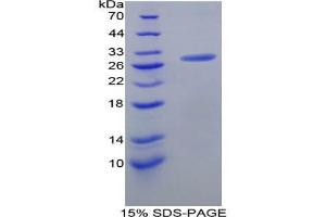 SDS-PAGE analysis of Mouse Caspase 8 Protein. (Caspase 8 Protein (CASP8))