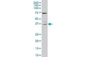 CD68 polyclonal antibody (A01), Lot # 060717JCS1. (CD68 Antikörper  (AA 164-262))