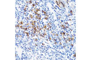 Immunohistochemistry of paraffin-embedded human tonsil using TNFSF12 Antibody (ABIN1876860) at dilution of 1:100 (40x lens). (TWEAK Antikörper)