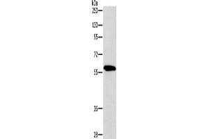 Western Blotting (WB) image for anti-P21-Activated Kinase 2 (PAK2) antibody (ABIN2428543) (PAK2 Antikörper)