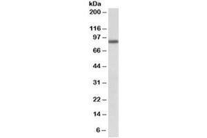 Western blot testing of A549 lysate with FGFR1 antibody at 1ug/ml. (FGFR1 Antikörper)