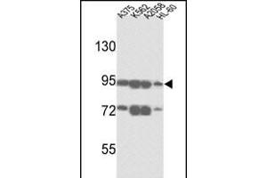 Western Blotting (WB) image for anti-ATP-Binding Cassette, Sub-Family B (MDR/TAP), Member 5 (ABCB5) (AA 1-30), (N-Term) antibody (ABIN390068)