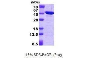 Figure annotation denotes ug of protein loaded and % gel used. (CAB39L Protein)