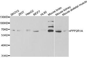Western blot analysis of extracts of various cell lines, using PPP2R1A antibody (ABIN5973416) at 1/1000 dilution. (PPP2R1A Antikörper)