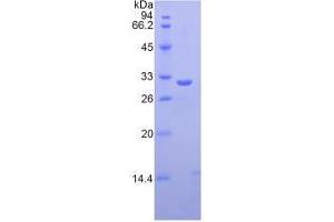 SDS-PAGE analysis of Human Ficolin 3 Protein. (FCN3 Protein)