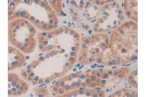 Detection of ACAT2 in Human Kidney Tissue using Polyclonal Antibody to Acetyl Coenzyme A Acetyltransferase 2 (ACAT2) (ACAT2 Antikörper  (AA 1-397))