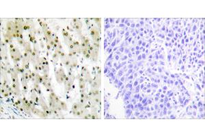 Peptide - + (HNRNPA1 Antikörper)