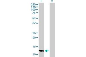 Western Blot analysis of LOC494141 expression in transfected 293T cell line by LOC494141 MaxPab polyclonal antibody. (SLC25A51P4 Antikörper  (AA 1-154))