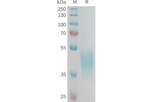 KIR2DL3 Protein (AA 22-245) (His tag)