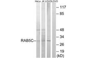 Western blot analysis of extracts from LOVO/HeLa/Jurkat cells, using RAB5C Antibody. (Rab5c Antikörper  (AA 122-171))