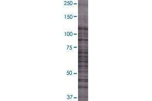 SAPS2 transfected lysate. (SAPS2 293T Cell Transient Overexpression Lysate(Denatured))