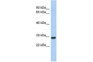 WB Suggested Anti-C21orf91 Antibody Titration:  0. (C21orf91 Antikörper  (Middle Region))