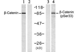 Western blot analysis of extracts from SW 626 cells , untreated or treated with Calyculin A (50nM, 30min), using β-Catenin (Ab-33) antibody (E021211, Lane 1 and 2) and β-Catenin (phospho-Ser33) antibody (E011218, Lane 3 and 4). (beta Catenin Antikörper)