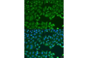 Immunofluorescence analysis of U2OS cells using MAP2K3 antibody (ABIN2737130) at dilution of 1:100. (MAP2K3 Antikörper)