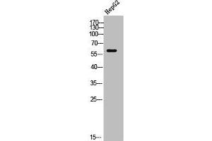 Western Blot analysis of HepG2 cells using TdT Polyclonal Antibody (TdT Antikörper  (Internal Region))