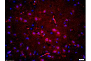 Formalin-fixed and paraffin embedded rat brain labeled with Anti-phospho-Tau protein(Thr181)Polyclonal Antibody, Unconjugated (ABIN1387422) at 1:200 followed by conjugation to the secondary antibody Goat Anti-Rabbit IgG, Cy3 conjugated used at 1:200 dilution for 40 minutes at 37 °C and DAPI staining (tau Antikörper  (pThr181))
