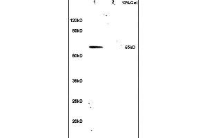 L1 rat lung lysates L2 human colon carcinoma lysates probed with Anti hnRNP L Polyclonal Antibody, Unconjugated (ABIN706631) at 1:200 in 4 °C. (HNRNPL Antikörper  (AA 501-589))