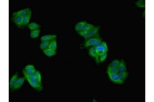 Immunofluorescent analysis of HepG2 cells using ABIN7144247 at dilution of 1:100 and Alexa Fluor 488-congugated AffiniPure Goat Anti-Rabbit IgG(H+L) (ASZ1 Antikörper  (AA 1-200))