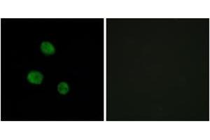 Immunofluorescence analysis of MCF7 cells, using hnRNP M Antibody. (HNRNPM Antikörper  (AA 11-60))