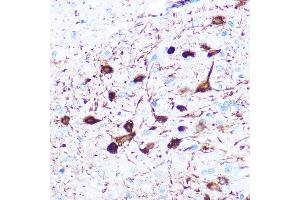 Immunohistochemistry of paraffin-embedded rat brain using gamma-Synuclein Rabbit mAb (ABIN3016563, ABIN3016564, ABIN1680688 and ABIN1680689) at dilution of 1:100 (40x lens). (SNCG Antikörper)
