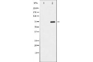 Western blot analysis of PKR phosphorylation expression in Starvation treated K562 whole cell lysates,The lane on the left is treated with the antigen-specific peptide. (EIF2AK2 Antikörper  (pThr446))