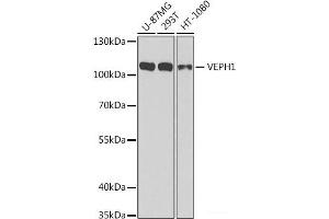 Western blot analysis of extracts of various cell lines using VEPH1 Polyclonal Antibody at dilution of 1:1000. (VEPH1 Antikörper)