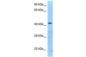 Image no. 1 for anti-Adenosine Deaminase, tRNA-Specific 3 (ADAT3) (AA 260-309) antibody (ABIN6748234) (ADAT3 Antikörper  (AA 260-309))