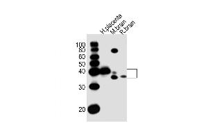 Western Blot at 1:1000 dilution Lane 1: human placenta lysates Lane 2: mouse brain lysates Lane 3: rat brain lysates Lane 4: rat brain lysates Lysates/proteins at 20 ug per lane. (JAM3 Antikörper  (C-Term))