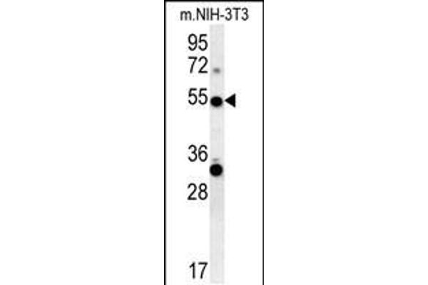 TRAF3 Antikörper  (C-Term)