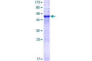 Image no. 1 for Family with Sequence Similarity 117, Member A (FAM117A) (AA 1-453) protein (GST tag) (ABIN1353429) (FAM117A Protein (AA 1-453) (GST tag))