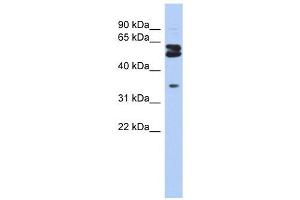 OGFOD1 antibody used at 1 ug/ml to detect target protein. (OGFOD1 Antikörper  (Middle Region))