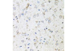 Immunohistochemistry of paraffin-embedded mouse brain using KLK11 antibody (ABIN5975048) at dilution of 1/100 (40x lens). (Kallikrein 11 Antikörper)