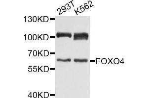 Western blot analysis of extracts of various cell lines, using FOXO4 antibody (ABIN5971698) at 1/1000 dilution. (FOXO4 Antikörper)