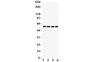 Western blot testing of IRF5 antibody and Lane 1:  human placenta;  2: rat thymus;  3: (r) kidney;  4: (r) ovary tissue lysate. (IRF5 Antikörper  (C-Term))