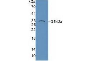 Western blot analysis of recombinant Human PTPN22. (PTPN22 Antikörper  (AA 1-233))