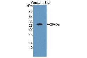 Western Blotting (WB) image for anti-Ubiquitin (Ubiquitin) (AA 1-76) antibody (ABIN1172489) (Ubiquitin Antikörper  (AA 1-76))