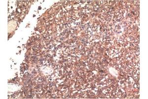 Immunohistochemical analysis of paraffin-embedded Human Brain Tissue using Tau Mouse mAb diluted at 1:200. (tau Antikörper)