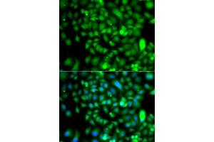 Immunofluorescence analysis of A549 cells using CSRP2BP antibody (ABIN5975516). (CSRP2BP Antikörper)