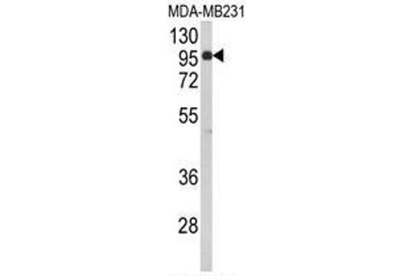 BAHD1 Antikörper  (C-Term)