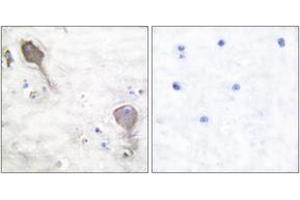 Immunohistochemistry analysis of paraffin-embedded human brain tissue, using Parkin Antibody. (Parkin Antikörper  (AA 1-50))