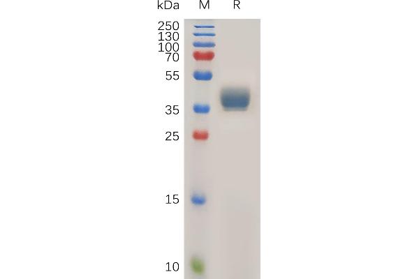 CCR1 Protein (AA 1-34) (Fc Tag)