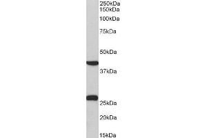 ABIN2562312 (0. (DUSP6 Antikörper  (C-Term))