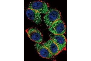 Immunofluorescence (IF) image for anti-Telomerase Reverse Transcriptase (TERT) antibody (ABIN2997736) (TERT Antikörper)