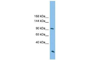 ARHGAP30 antibody used at 1 ug/ml to detect target protein. (ARHGAP30 Antikörper  (N-Term))