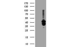 Western Blotting (WB) image for anti-Prenyl (Decaprenyl) Diphosphate Synthase, Subunit 2 (PDSS2) antibody (ABIN1500139) (PDSS2 Antikörper)